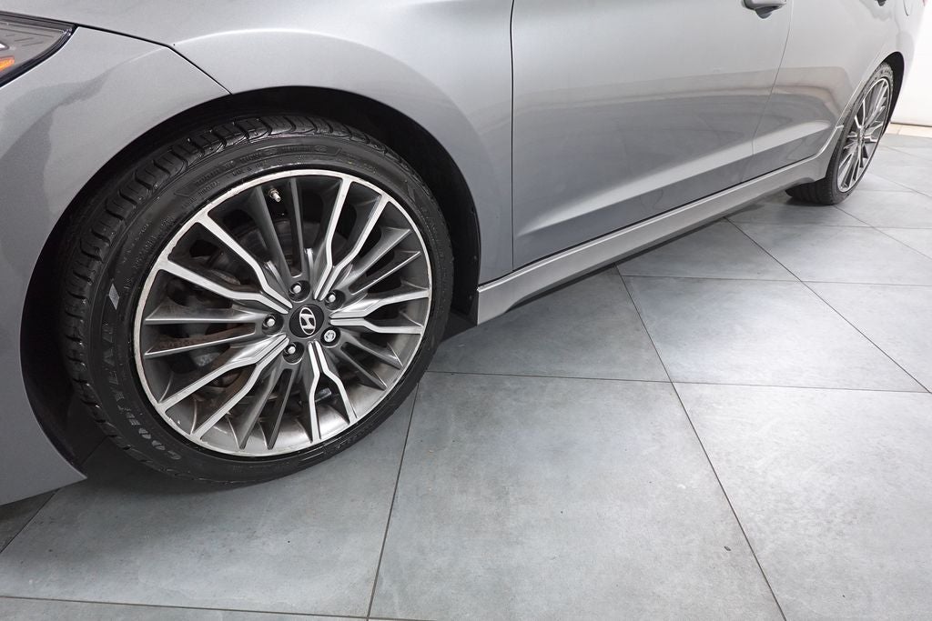 2018 Hyundai Elantra Sport